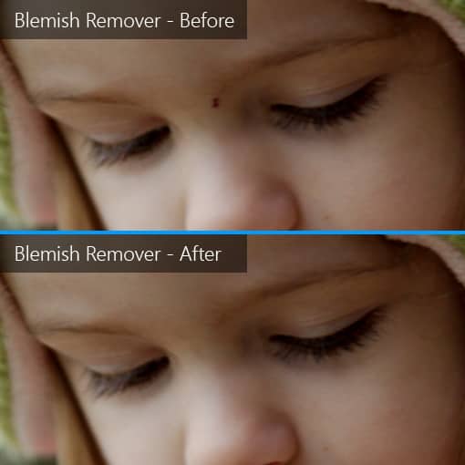 Blemish Remover