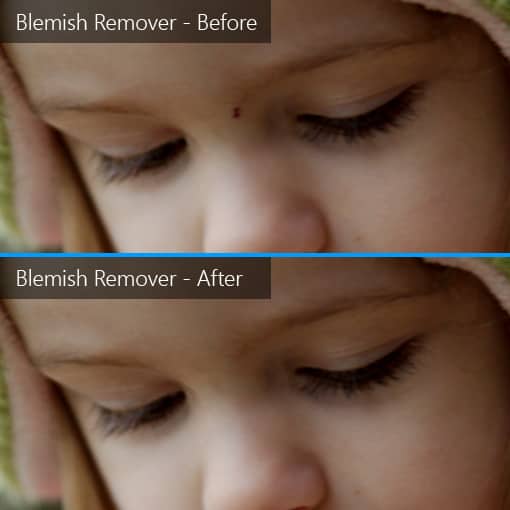 Click to enlarge Blemish Remover